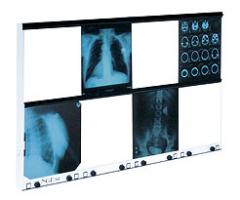 Negatoskop wysokiej częstotliwości - 6